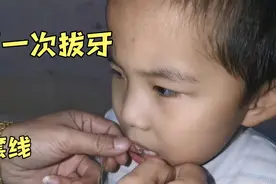 6岁小男孩第一次换牙，爸爸用一条线轻松拔掉，一点都不费劲