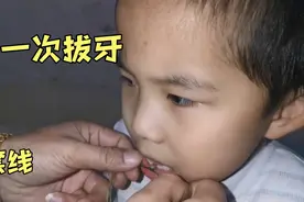 6岁小男孩第一次换牙，爸爸用一条线轻松拔掉，一点都不费劲视频封面
