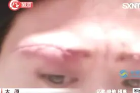 女子美容院内做“切眉术”，眼睛青紫一直抽搐，工作人员离职跑路视频封面