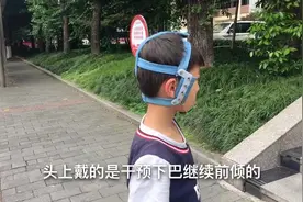 8岁孩子矫正牙齿地包天，终于戴上了矫治器，比想象中要顺利视频封面