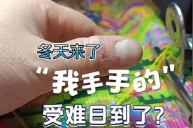 一到冬季，这双手就毁了。视频封面