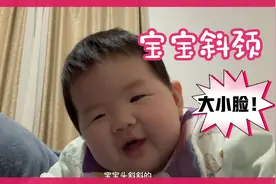 宝宝四个月出现斜颈大小脸，看看我是怎么做的？视频封面