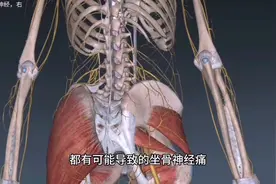 腰椎间盘突出症和梨状肌综合症引起坐骨神经痛的区别，如何区分？视频封面