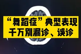 糖尿病患者不自主运动，诊断“舞蹈症”典型CT、MR表现，别漏诊！视频封面