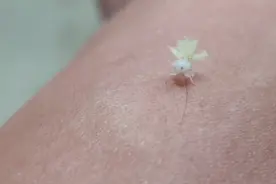 蜘蛛界的精灵，萌萌的白色小跳蛛视频封面