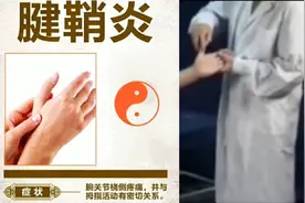 腱鞘炎推拿调理，视频主要讲解腱鞘炎的治疗方法，大家认真观看。