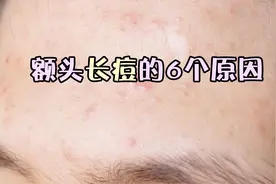 额头长痘6个原因你中了几个？视频封面