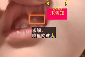 求助大家，上嘴唇，长个肉球？到底是什么❓❓视频封面