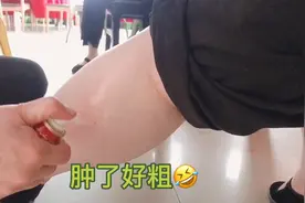 小腿突然酸肿痛，忍痛2天忍不住，狠下心买34.5元云南白药喷雾剂视频封面