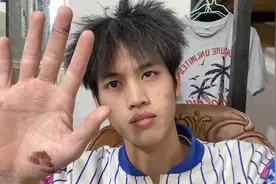 长时间手指碰冷胶水，开始出现裂纹了，不过有件事让我更加难过视频封面