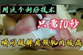 用这个刮痧技术，只需10秒！马上缓解肩颈劳损、酸痛！技术详解