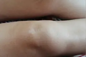 神奇的、可以左右晃动的膝盖骨！是病变、畸形还是别的问题？求解