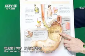 幽门螺杆菌多发于我们人体的哪一部位呢？来听听专家的讲解视频封面