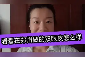 宝妈终于去做了双眼皮，小眼睛立马变大了一圈，大家看看怎么样视频封面