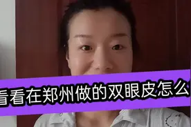 宝妈终于去做了双眼皮，小眼睛立马变大了一圈，大家看看怎么样视频封面