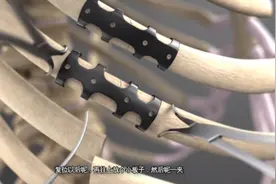 肋骨断裂修复动画视频封面