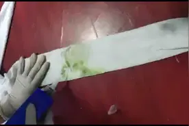 衣服草渍去除视频封面