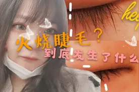 在线求助|用火安全|只是想热个鸡蛋却烧到睫毛，请大家引以为戒视频封面