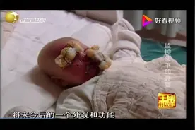 医院楼道惊现弃婴，全身布满伤痕，医生检查后竟发现是人为。视频封面