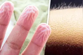 为什么起鸡皮疙瘩？揭秘人体的特殊反应！不要憋喷嚏！
