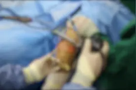 跟腱断裂手术后，总感觉跟腱变短了？怎样康复锻炼能把跟腱拉长？