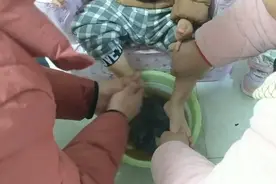 20个月宝宝上火流鼻涕，看看妈妈煮了一锅什么！用来泡脚治疗感冒视频封面