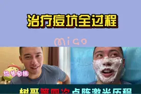 点阵激光治疗痘坑过程视频封面