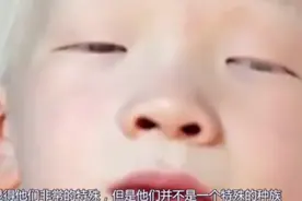 世界上最珍贵的人，血液比黄金还贵。视频封面