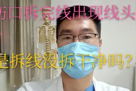 伤口拆完线以后，过段时间出现了线头，是手术缝线没拆干净吗？视频封面