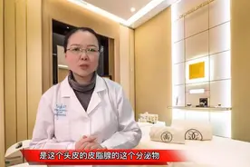 宝宝头上的乳痂不要用手扣，育儿专家教你方法，几天就干净了视频封面
