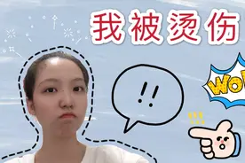 在家光荣负伤，女孩子的“第二张脸”被烫伤，在家也一定注意安全视频封面