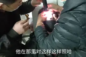 不小心眼球里进了个铁沫，诊所大夫废了好大劲剥出来，只收十五元视频封面