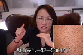 手臂，大腿上一粒粒凸起的疹子是什么？什么是毛囊角化症？视频封面