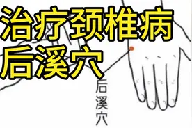 低头时间长了，颈椎僵硬酸痛，治疗颈椎病的特效穴——后溪穴视频封面