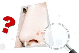 鼻翼上总长痘痘是怎么回事？发病原因主要有这三点视频封面
