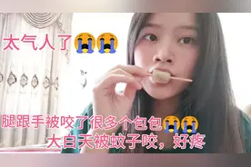 广东天气太奇葩了，才二月份就那么热，蚊子又多，被咬了很多包包视频封面