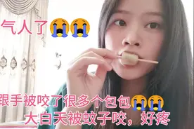 广东天气太奇葩了，才二月份就那么热，蚊子又多，被咬了很多包包视频封面