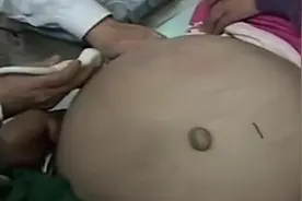 四岁女孩患上怪病，肚子大得像八个月，专家检查后被震惊了！视频封面