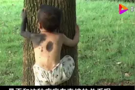 男孩天生患怪病，诊断结果让母亲难以接受，医生：近亲结婚造成视频封面