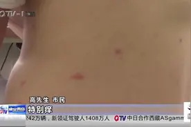 市民被螨虫叮咬 身上奇痒无比 一招教你消肿止痒！视频封面