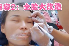 为了变好看，陈梦经历4个小时全脸大改造，没想到术后变化这么大视频封面