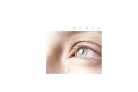 眼睛总流泪可能是泪道病？点进来让我们告诉你视频封面