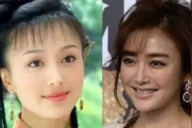 女明星如何保持容颜？秦岚大方承认靠医美冻龄，表示整容是因敬业视频封面