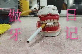 活动假牙快速制作，原来牙齿也有这么简单！视频封面