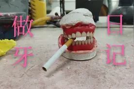 活动假牙快速制作，原来牙齿也有这么简单！视频封面