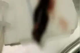 细思极恐！9岁女孩泳池游泳后常流鼻血，鼻子里竟钻进蚂蝗视频封面