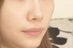 轻微脸部抽搐是怎么回事？严重吗？医生建议这样调理