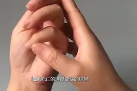 手指上长满竖纹~老中医说漏嘴~现在知道还不晚。