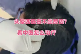 头部点刺放血治疗头晕，38岁女患者：头晕真是轻多了