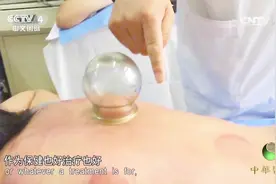 拔罐治疗后，中医总会在心腧穴拔罐，这是为什么？听听他的解释视频封面
